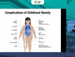Dianggap Bukan Penyakit, Obesitas Justru Ancam Picu Komplikasi